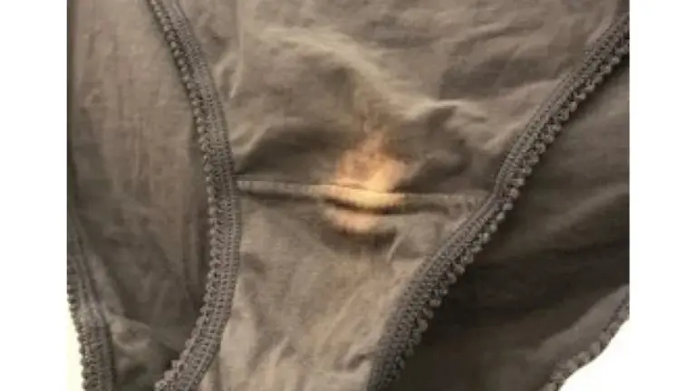 Por qué las doctoras ven manchas blancas en tu ropa interior (y no es lo que crees)