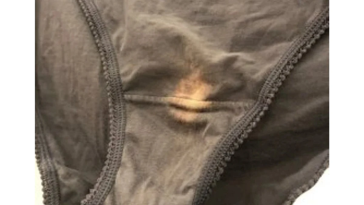 Por qué las doctoras ven manchas blancas en tu ropa interior (y no es lo que crees)